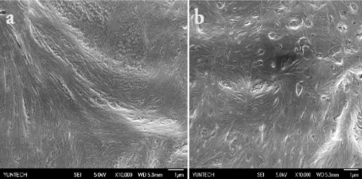 Representative SEM images of xerogel of BCC-ED.