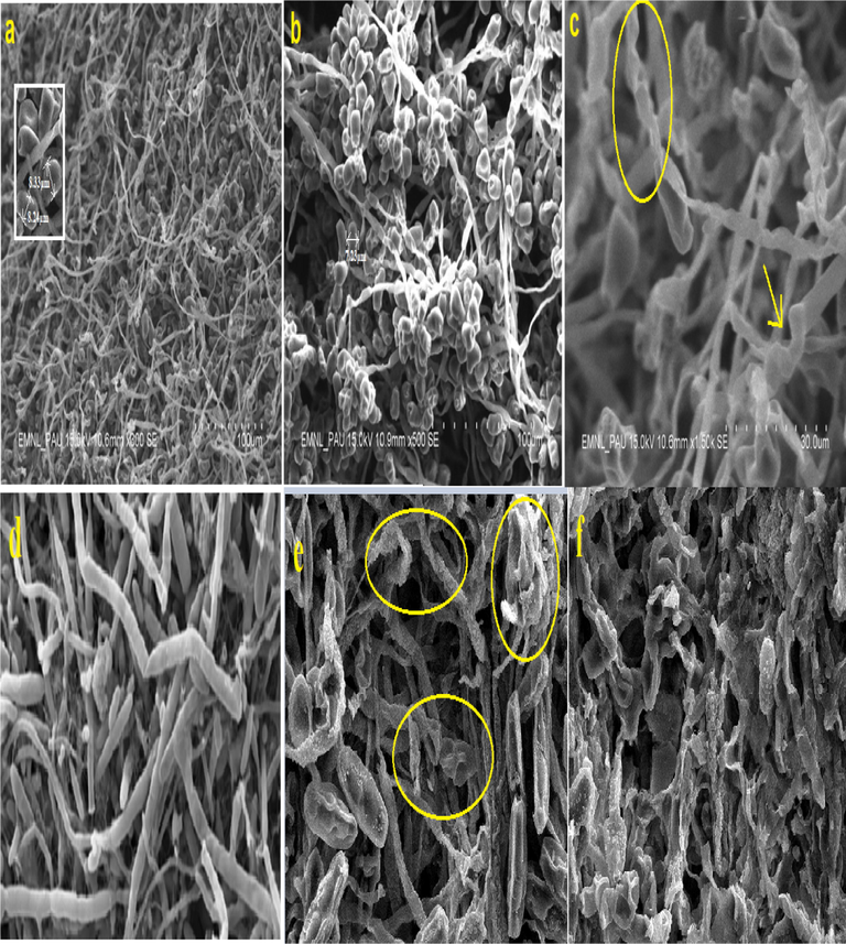 (a–f). Scanning electron microscopy of (a–c) C. lunata (a) control, (b) shrinkage and reduction of spore when treated with compound 8 (100 μg/ml), (c) deformation and disruption of hyphae, (d–f) F. fujikuroi (d) control with smooth cell wall, (e) shrunken spores and deformation of hyphae and (f) severe deformation of hyphae when treated with compound 8 (100 μg/ml).