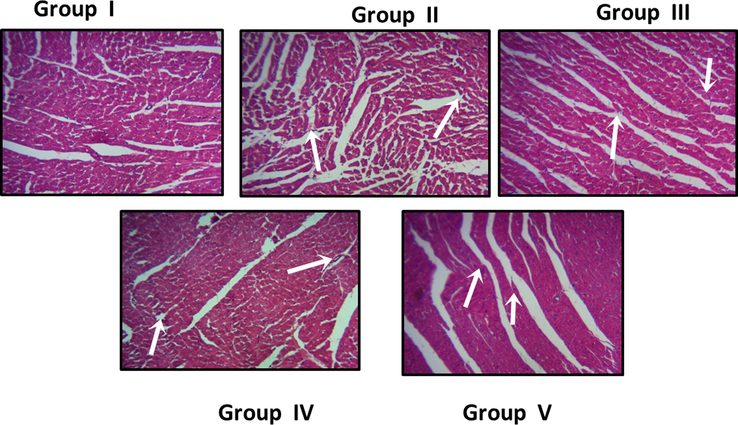 Effect of biosynthesised on PC-AuNPs cardiac tissue histomorphometry on high fat diet fed diabetes induced rats. The cardiac tissues of control (Group I), low dose (Group IV), and high dose (Group V) of PC-AuNPs treated animal shows a regular pattern of cardiac myofibres with oval shaped nuclei located centrally on the cardiomyocytes. Whereas irregular pattern of cardiac myofibres were observed in high-fat diet fed rats (Group II) and high-fat diet fed diabetes induced rats (Group III).