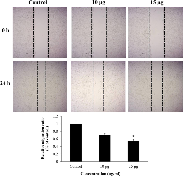 EF-ZnONPs inhibit the cell migration of A549 cells. The EF-ZnONPs (10 and 15 µg/ml) treated A549 cells significantly inhibited the cell migration, whereas the control cells revealed increased cell migration.