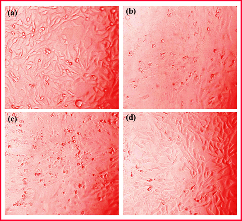 Optical images showing the cell viability of MG63 human osteoblast cells on TNT/CS-CA@M-HAP (II) coatings for (a) 1, (b) 4 days and (c) 7 days of incubation.