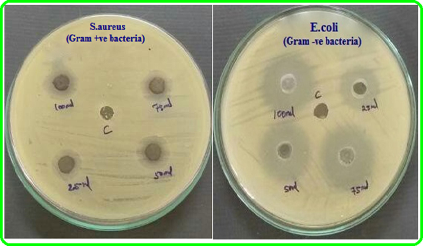 Qualitative antibacterial activity of sample TNT/CS-CA@ M-HAP (II) coated on Ti specimen against gram positive and gram negative bacteria.