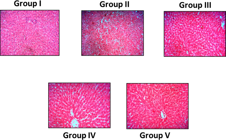 Photomicrographs show the effects of SC-AuNPs on liver histology of control and obese rats. Groups: (Group I) normal diet rats; (Group II) control obese rats; (Group III) obese rats treated with 10 mg/kg bwt; (Group IV) obese rats treated with 20 mg/kg bwt; (Group V) obese rats treated with 30 mg/kg bwt.