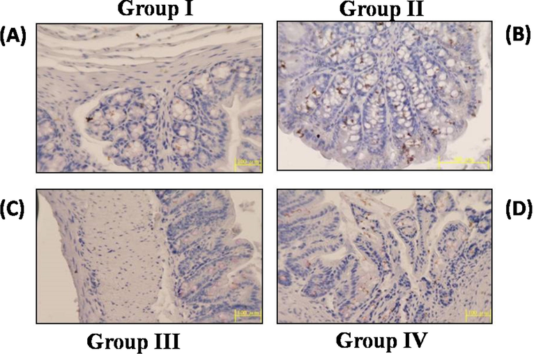 Effect of Hesperidin on iNOS by immunohistochemistry in control and experimental rats. The iNOS expression of control and experimental animals in each group (20×). A & D iNOS expression in control and hesperidin (10 mg/kg b.w.) administered animals. B. Shows the over expression of iNOS in DMH alone treated. C. Shows the diminished expression of iNOS in DMH + hesperidin (5 mg/kg b.w.) administered animals.