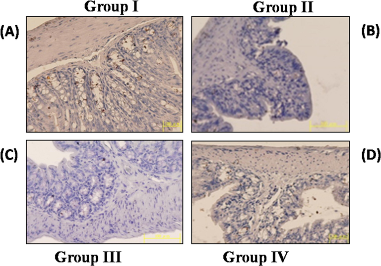 Effect of Hesperidin on COX-2 by immunohistochemistry in control and experimental rats. The COX-2 expression of control and experimental animals in each group (20×). A & D COX-2 expression in control and hesperidin (10 mg/kg b.w.) administered animals. B. Shows the over expression of COX-2 in DMH alone treated. C. Shows the diminished expression of COX-2 in DMH + hesperidin (5 mg/kg b.w.) administered animals.