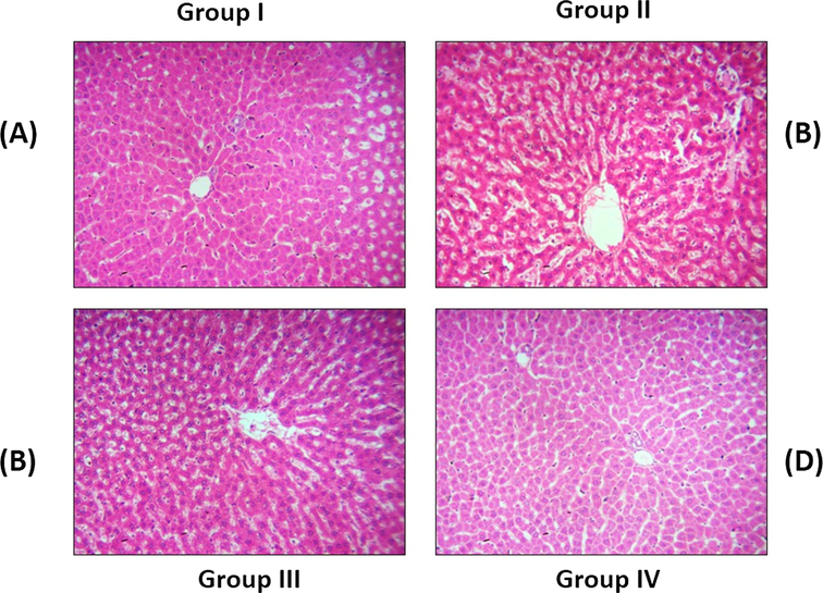 Histopathology of Liver on control and experimental rats. Histological results of liver of control and experimental rats [H&E staining]. (a and d) control and DMH along with hesperidin (10 mg/kg body weight) rats showing normal & moderate liver architecture. 1,2-Dimethylhydrazine (DMH) alone rat liver (group II) displays vesicular type of fatty alterations, Kupffer cell hyperplasia, nuclear pleomorphism and provocative cell infiltrate in the portal chord. The liver section of DMH + hesperidin 10 mg/kg b.w. (group III) rat depicted noticeable seditious cell permeate and neoplastic cells. The liver of DMH + hesperidin 5 mg/kg body weight (group IV) showing near normal architecture. Histological alterations were pointed out by the arrow marks.