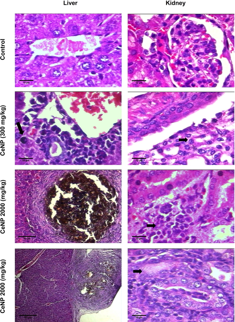 Histopathology analysis - the liver was examined: Control - Normal hepatocytes, isomorphic; CeNP (300 mg/kg) group - presence of inflammatory infiltrate around the lobular vein and rare foci of hepatocellular necrosis (arrows point); CeNP (2000 mg/kg) group - multifocal sub-capsular granulomatous inflammatory processes. Histopathology analysis - the kidneys were examined: Control - Glomerulus preserved with thin Bowman's capsule, capillary tuft supported by delicate mesangium; CeNP (300 mg/kg) group - Distal convoluted tubule normal, and discreet increase in the number of portal lymphocytes, along with some polymorphonuclear neutrophils in rare portal spaces (arrows point); CeNP (2000 mg/kg) group - focal interstitial nephritis (arrows point). Hematoxylin-Eosin. All the images were 400× the original magnification.