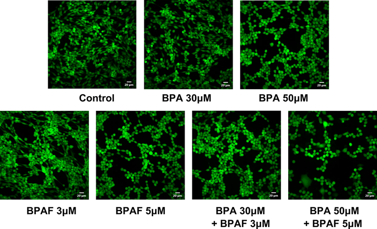 Cell viability changes in KGN cells after exposure to BPA and/or BPAF. Images of cell viability in KGN cells after exposure to BPA and/or BPAF. KGN cells were labeled using calcein AM probes. Scale bar = 20 μm.