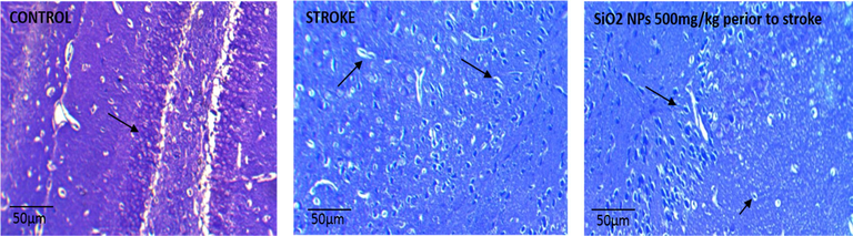 Photomicrograph of the CA1 region of the rat hippocampus in the experimental groups by Nissl staining Zoom × 4 (A) Control group (healthy neurons and healthy nuclei and euchromatin). (B) Stroke group (necrotic, degenerate and pyknoses cells with heterochromatin nucleus). (C) SiO2 NPs 500 mg/kg + Stroke (decrease of necrotic cells).