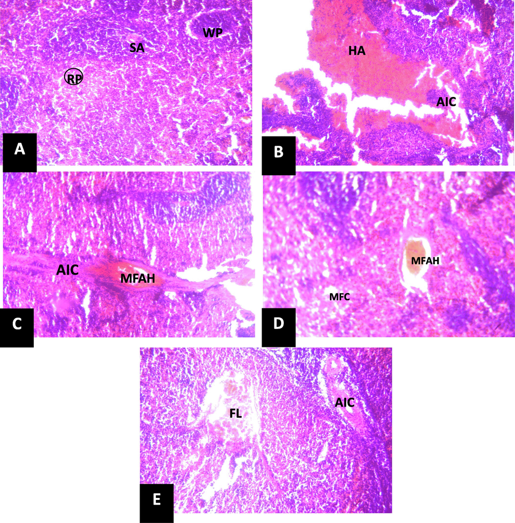 Photomicrograph of section of spleen (X150) (H/E).