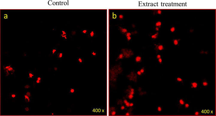 Cancer cell death due treatment of Senna leaf extract: It shows the impact of treatment of Senna leaf extract on colon cancer cells (HCT-116) stained with Propidium iodide (PI) post 48 h treatment. In this figure, (a) represents the control cell with few cell death and (b) a significant number of cancer cells due to (20 µg/ml) treatment.