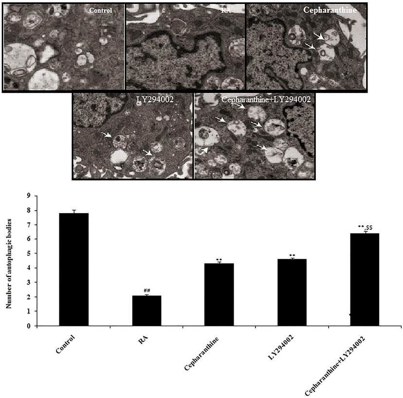 Cepharanthine and LY294002 treatment ameliorated chondrocyte autophagy in cartilage tissue of RA rats. Mean ± SEM (n = 10); ##p < 0.01 compared with control group, **p < 0.01 compared with RA group, $$p < 0.01 compared to cepharanthine-treated and LY294002-treated groups.