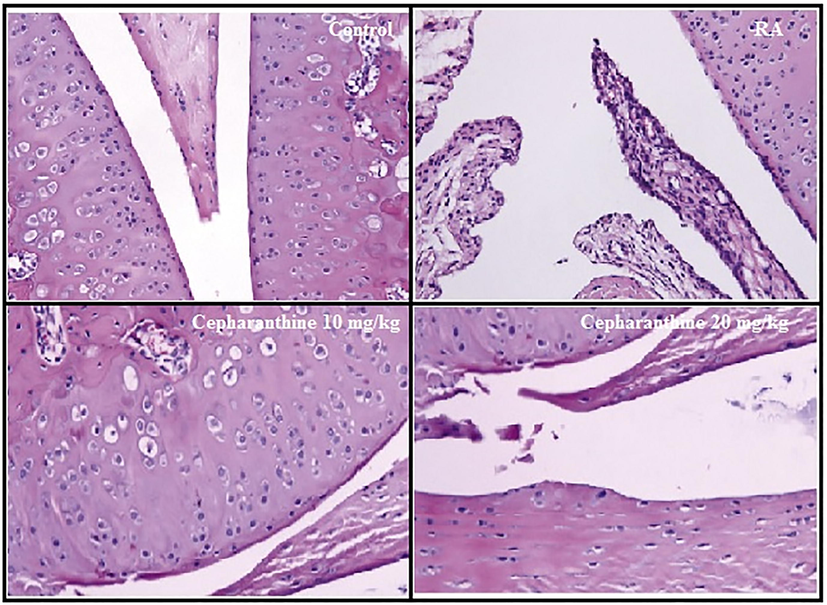 Cepharanthine treatment ameliorated histopathological changes in cartilage tissue of RA rats.