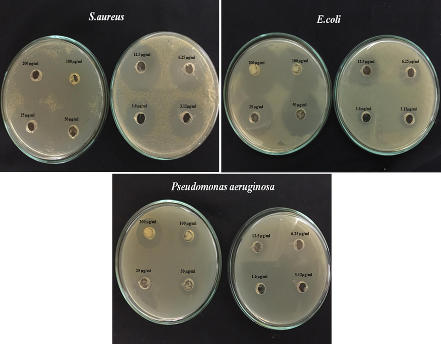 Visible zone produced by varying concentrations (200–3.12 µg/ml) of Al2O3 NPs against S. aureus, E. coli and P. aeruginosa.