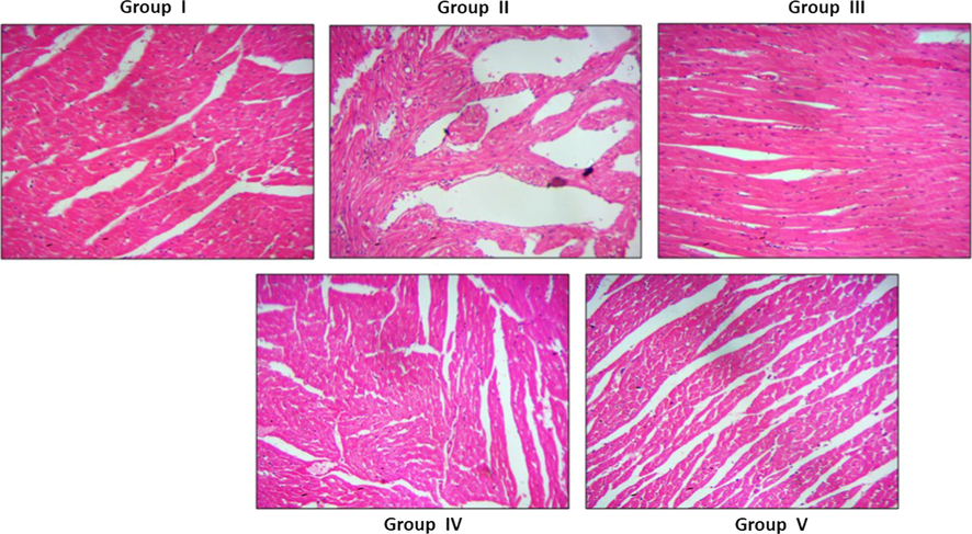 Effect of synthesized Betulinic acid loaded PVA/Lig-g-MA nanoformulation on cardiac tissue histomorphometry in high fat diet induced atherosclerotic rat model. The cardiac muscle of control and experimental rats were processed for histological analysis and sectioned into slices of 5 µm thickness. The sectioned slides were stained with haematoxylin and eosin stains. The stained slides were viewed under light microscope and photographed. The experiments were performed in triplicates.