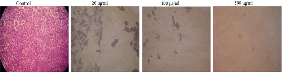 Morphological changes induced by AuNPs on the liver cancer cell line (HepG-2).