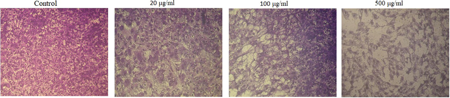 Morphology image of breast cancer (MCF-7) treatment by AuNPs at 20, 100, 500 μg/ml respectively.