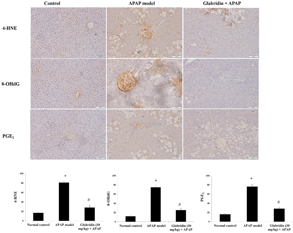 Effect of glabridin on 4-HNE, 8-OHdG, and PGE2 immunohistochemical expressions in APAP-induced rats. Data were shown as mean ± SD (n = 6). Data were shown as mean ± SD (n = 6). ‘*’ represents statistical difference (p < 0.05) from normal group I, whereas ‘#’ represents statistical difference (p < 0.05) from APAP-induced group II. Representation of staining percentage was done based on the quantification using optical density of positively stained areas at 100 × magnification.