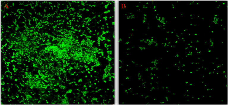 CLSM showing antibiofilm activity of ZnO NPS against PAO1. [A] Control; [B] treated with 300 µg/mL of ZnO NPs.