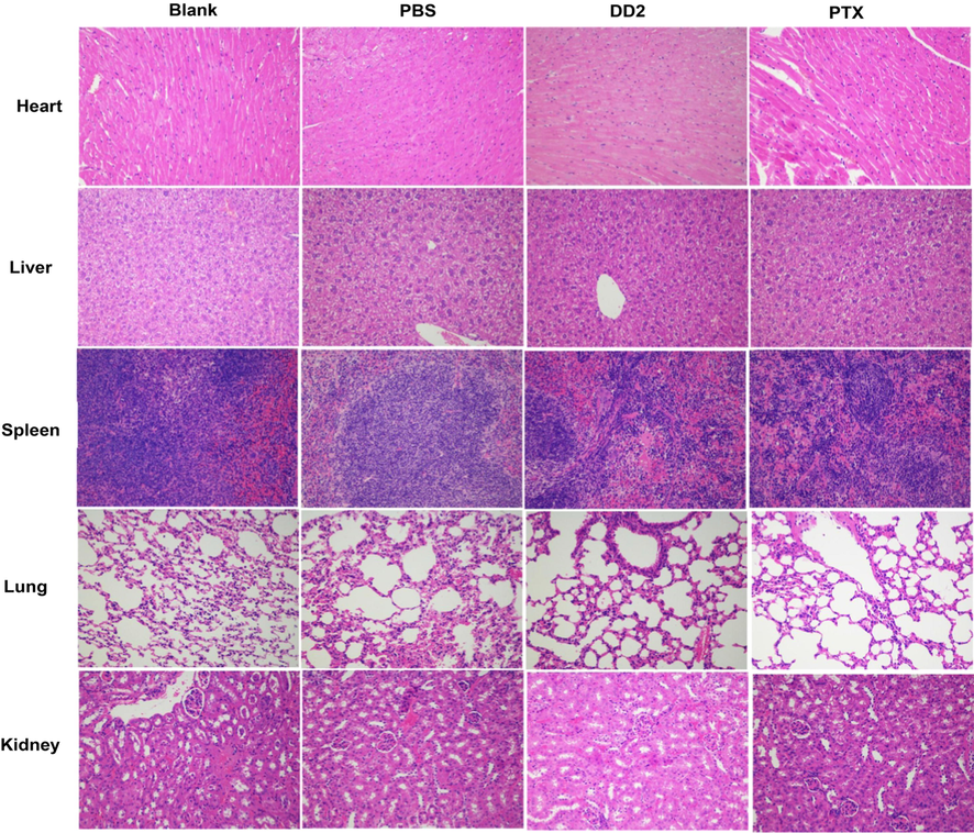 Histological analysis of major organs from mice in different groups.