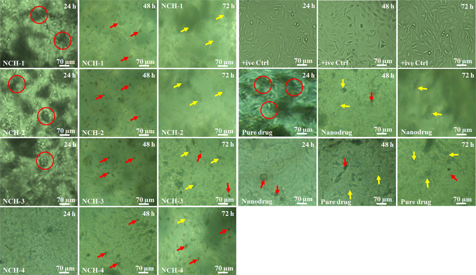 Cell morphology against different anticancer agents at a different time interval (24, 48 and 72 h). The red circles show the cell cluster, red arrows indicating dead cells and yellow arrows present the rupture cell membrane.