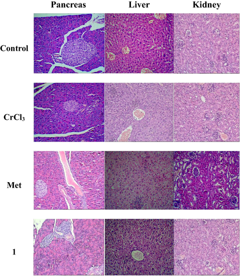 Histopathological images of pancreas, liver and kidney sections treated CrCl3, Met and complex 1 at dose 1.0 g Cr/kg BW.