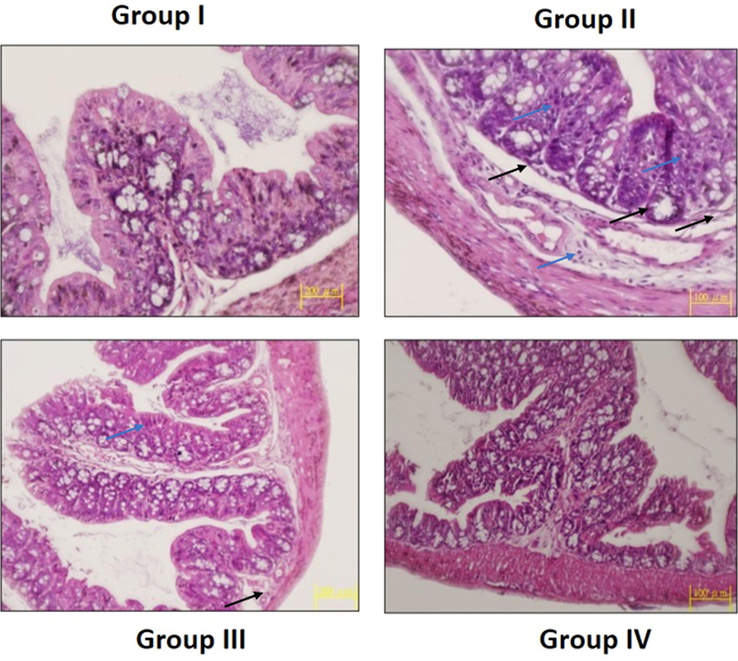 Effect of SAP-Ally-NCs on the colon histology of experimental rats. Control rats exhibited the usual cellular arrangements without any lesions (Group I). The DMH-triggered animals demonstrated the severe histological alterations, epithelial lining damages (black arrows) with dysplasia (blue arrows) cells (Group II). The SAP-Ally-NCs (10 and 15 µM/kg) treated rats effectively ameliorated the DMH-challenged histological changes (Group III & IV).