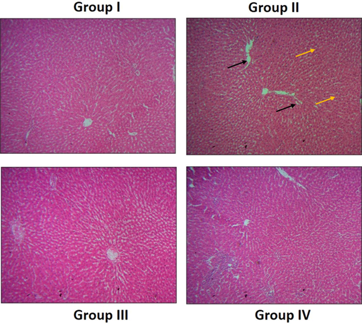 Effect of SAP-Ally-NCs on the liver histology of experimental rats. The liver tissues of control rats displayed the usual cellular patterns without any damages and lesions (Group I). DMH-challenged rats demonstrated the increased hyperplasia (yellow arrows) and hepatocyte (black arrows) damages (Group II). AP-Ally-NCs (10 and 15 µM/kg) administered animals exhibited the improved liver histology with reduced hepatocytes damages and attenuated the histological changes (Group III & IV).