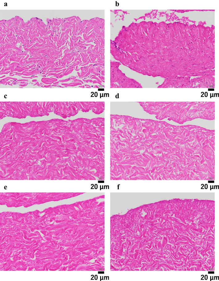 Haematoxylin-eosin (H-E) staining. (a) Untreated. (b) Dimethyl ether (DME) extraction only (c–f) DNase treatment for 1 (c), 3 (d), 5 (e), and 7 (f) days following DME extraction.