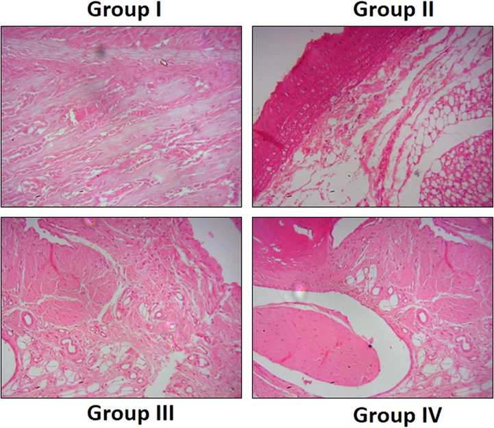 Effect of SCP-CAR nanoparticle composites on histopathological investigation of hind paw of CFA induced arthritic rats (Magnification x400) Group I: Control animals; Group II: Animals induced with arthritis using CFA; Group III: CFA induced arthritic rats + SCP-CAR nanoparticle composites; Group IV: CFA induced arthritic rats + Diclofenac Sodium.