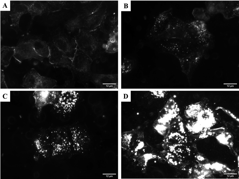 Dark-field images of MCF-7 cells showing a time-dependent uptake of PS-modified Au@PdNDs.DOX. (A) Untreated control, (B) 2 h, (C) 6 h, (D) 24 h exposure time, respectively. Images were acquired at 60× magnification (Scale bar = 12 µm).