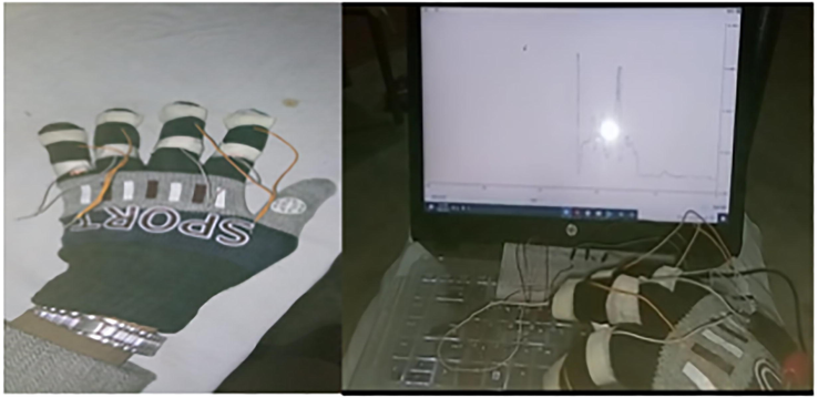 Fingers movement monitoring.