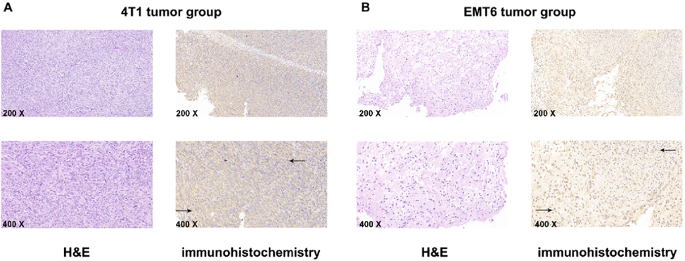 H&E staining and immunohistochemistry staining. A. 4T1 tumors, representative microscopy images (200 × and 400 × ) of H&E and immunohistochemistry staining for EphA2, black arrow refers to the positive area (brown). B. EMT6 tumors, representative microscopy images (200 × and 400 × ) of H&E staining and immunohistochemistry staining for EphA2, black arrow refers to the positive area (brown). Representative result was from five independent experiments.