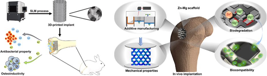 The 3D manufactured bone implant process [171–172].