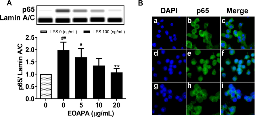 Effects of EOAPA on NF-κB p65 nuclear translocation. RAW264.7 cells were pre-treated with various concentrations of EOAPA for 1 h, and then LPS-stimulated during 1 h. (A) The content of p65 in the nucleus was determined by simple western immunoblotting. (B) Cells were fixed, permeabilized and conducted immunofluorescence assay. a–c control group, d–f LPS induced group, g–i 20 μg/mL EOAPA pre-treated and then LPS induced group. Data represent Mean ± SD (n = 3). # p < 0.05, ## p < 0.01 versus control group; ** p < 0.01 versus LPS group.