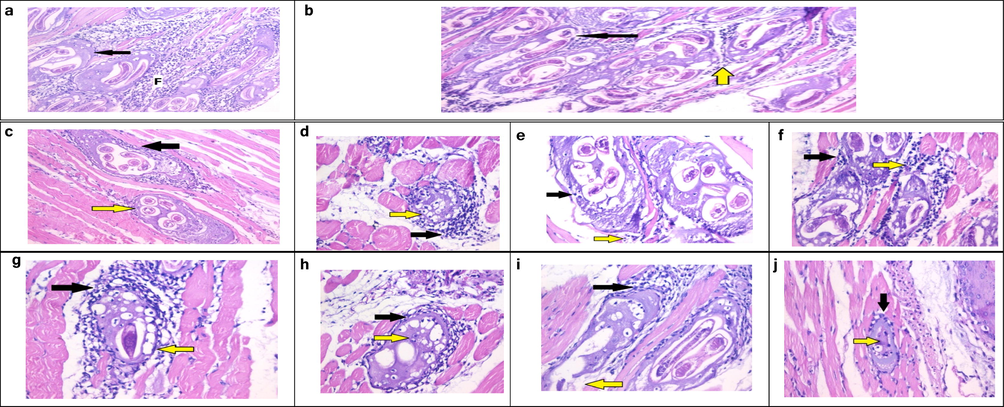 (a) Histopathological examination of sections from skeletal muscle of G-I, showing intact capsules (arrow) and pericapsular plasma-lymphocytic inflammatory cellular infiltration (F) (H & E stain, X200). (b) Histopathological examination of sections from skeletal muscle of G-II, showing many Trichina capsules with degenerated capsules (black arrow) invaded by many macrophages (yellow arrow) (H & E stain, X200). (c) Group IIIb, showing mild degeneration of the capsule (yellow arrow) surrounded and invaded by many macrophages (black arrow) (H & E stain, X200). (d) Group IVb, showing degenerated capsules (yellow arrow) and focal pericapsular plasma-lymphocytic inflammatory cellular infiltration (black arrow) (H & E stain, X400). (e) Group Vb, histopathological examination of sections from skeletal muscle of G-IIIc, showing degenerated capsules (yellow arrow) and focal pericapsular plasma lymphocytic inflammatory cellular infiltration (black arrow) (H&E stain, X400). (f) Group VIb, showing degenerated capsules (black arrow) and pericapsular plasma-lymphocytic inflammatory cellular infiltration (yellow arrow) (H & E stain, X 400). (g) Group IIIc, showing degenerated capsules (black arrow) and focal pericapsular plasma-lymphocytic inflammatory cellular infiltration (yellow arrow) (H & E stain, X400). (h) Group IVc, showing markedly degenerated capsules (black arrow) and larva with invasion by many macrophages (yellow arrow) H & E stain, X400). (i) Group Vc, showing focally degenerated capsules (yellow arrow) and dense pericapsular plasma-lymphocytic inflammatory cellular infiltration (black arrow) (H & E stain, X200). (j) Group VIc: Showing smaller Trichina capsule with degenerated content (yellow arrow) and mild pericapsular plasma-lymphocytic inflammatory cellular infiltration (black arrow) (H&E stain X200).
