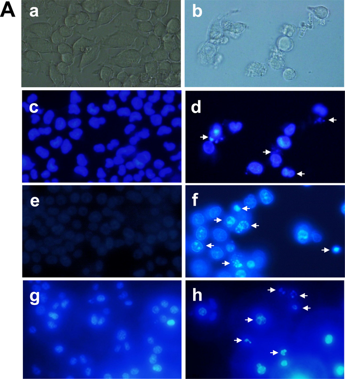 Cell morphological change after staining with Hoechst 33342 dye and ROS generation after treatment with chitinase. (A) Optical microscopic view of the control MCF-7 cells (a) and treated MCF-7 cells (b); fluorometric image of the control MCF-7 cells (c) and treated MCF-7 cells (d); fluorometric image of the control HCT-116 cells (e) and treated HCT-116 cells (f); fluorometric image of the control EAC cells (g) and treated EAC cells (h), Arrow indicating apoptotic cells. (B) Optical microscopic view of the control and treated HCT-116 cells in (a) and (b) respectively; fluorometric images of control & treated HCT-116 cells and fluorometric images of control & treated MCF7 cells were represented by (c), (d), (e) and (f), respectively. Pictures were captured in 40x magnification.