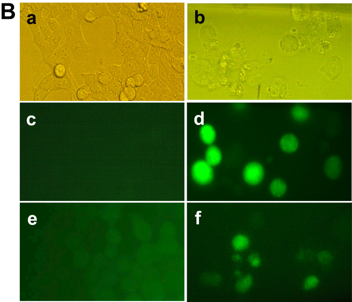 Cell morphological change after staining with Hoechst 33342 dye and ROS generation after treatment with chitinase. (A) Optical microscopic view of the control MCF-7 cells (a) and treated MCF-7 cells (b); fluorometric image of the control MCF-7 cells (c) and treated MCF-7 cells (d); fluorometric image of the control HCT-116 cells (e) and treated HCT-116 cells (f); fluorometric image of the control EAC cells (g) and treated EAC cells (h), Arrow indicating apoptotic cells. (B) Optical microscopic view of the control and treated HCT-116 cells in (a) and (b) respectively; fluorometric images of control & treated HCT-116 cells and fluorometric images of control & treated MCF7 cells were represented by (c), (d), (e) and (f), respectively. Pictures were captured in 40x magnification.