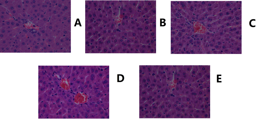 Histological images of the liver. A. Control. B. Model. C. Positive control. D. YL high dose. E. YL low dose (400X magnification).