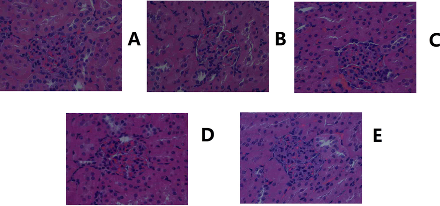 Histological images of the kidney. A. Control. B. Model. C. Positive control. D. YL high dose. E: YL low dose (400X magnification).