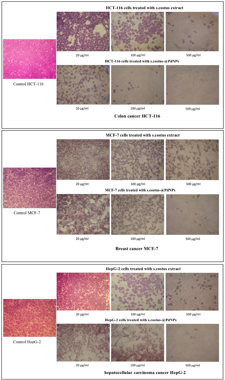 Effect of synthesized. S.costus-@PdNPs on morphological assessment of HCT-116, HepG-2, and MCF-7 cells.