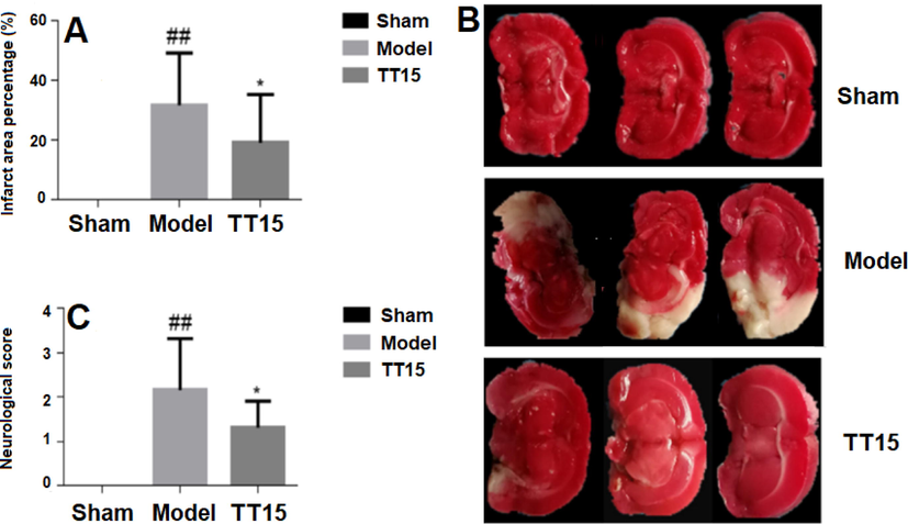 The effect of TT15 on MCAO, cerebral infarct size (A), representative TTC staining of brain tissue (B), and neurological function score (C). ##P < 0.01, Model vs Sham group; *P < 0.05, TT15 vs Model group.