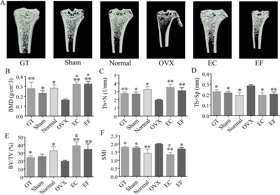 The region of interest (ROI) image and bone parameters analysis in tibia in different rats: (A) ROI image of sham, normal, ovariectomized (OVX), Gushukang-treated (GT), Eucommia cortex–treated (EC), and Eucommia folium–treated (EF) groups. (B) Comparison of bone mineral density (BMD) in six groups. (C) Comparison of trabecular number (Tb × N) in six groups. (D) Comparison of trabecular separation (Tb × Sp) in six groups. (E) Comparison of percent bone volume (BV/TV) in six groups. (F) Comparison of structure model index (SMI) in six groups. Values were expressed as the mean ± standard deviation (SD); n = 6. *p < 0.05, **p < 0.01 compared with the OVX group. # p < 0.05, ##p < 0.01 compared with the sham group.