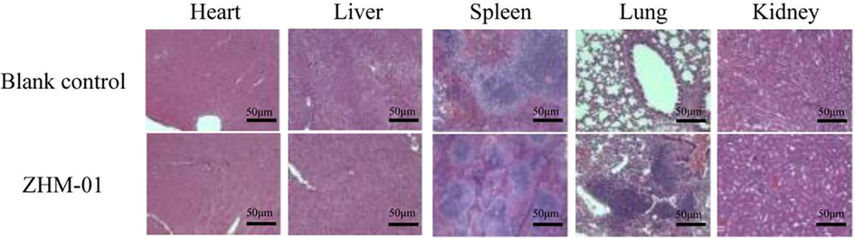 Hematoxylin and eosin-stained histological sections of the heart, liver, spleen, lung, and kidneys at 21 days after mice were treated with ZHM-01 (0.0196 mmol/kg/day) or 0.9% sodium chloride (blank control). The images were obtained using a Leica microscope. Magnification, 400 ×. Scale bar = 50 μm.