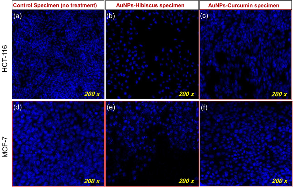 Disintegration of colon and breast cancer cell DNA (200x): (a-c) Impact of AuNPs-Hibiscus and AuNPs-Curcumin on colon cancer cells (HCT-116), post 48 h treatment (0.8 µg/ml). (d-f) Impact of AuNPs-Hibiscus and AuNPs-Curcumin on breast cancer cells (MCF-7) after treatment of 48 h (0.8 µg/ml).