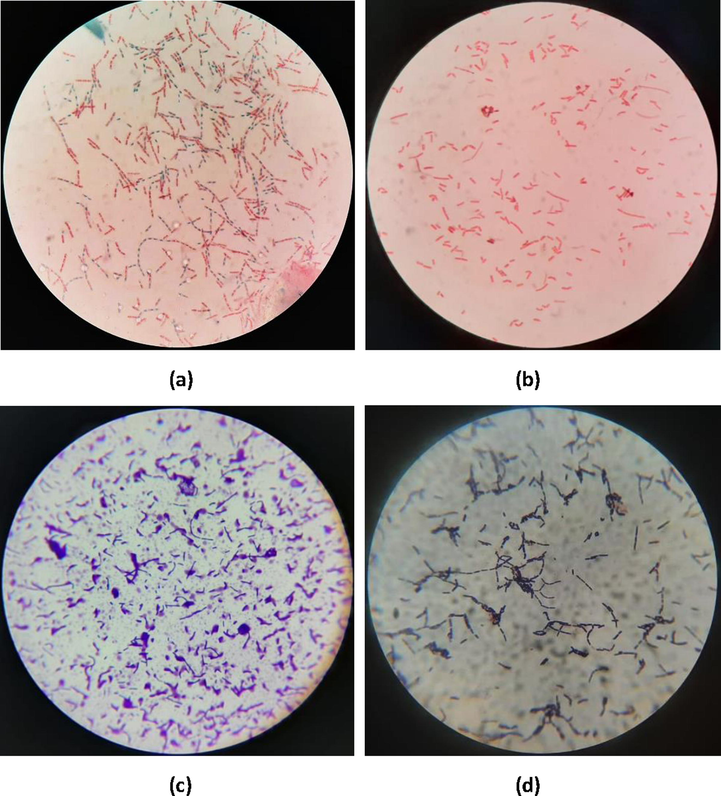 Microscopic images of B. subtilis (a) spore stain after through SiG filter, (b) spore stain after through AgNPs-[chi-SiG] filter, (c) Gram stain after through SiG filter, and (d) Gram stain after through AgNPs-[chi-SiG] filter with 1.000 × magnification using a microscope.