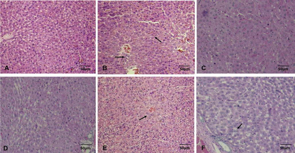 The H & E stained histopathology photos of the liver. Control/NS group: which received saline (Fig. 5A); CCl4 group: the cirrhotic group which received CCl4 injections (0.4 g/kg, i.p.), a solution of 1:6 of CCl4 in mineral oil (Fig. 5B); Bu 30 and Bu 60 groups: which received bupropion orally at doses 30 and 60 mg/kg/day, p.o (Fig. 5C, 5D); CCl4 + Bu 30 and CCl4 + Bu 60: treatment groups which received CCl4 + bupropion (30 and 60 mg/kg/day, p.o.) (Fig. 5E, 5F).