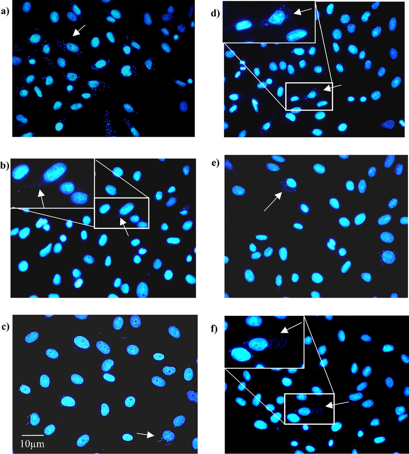 Trypanocidal effect of 8 alone or combined with BZN on the amastigote forms of T. cruzi. Vero cells were exposed to a 1:3 ratio for 24 h, after which the supernatant was removed, and the cells were exposed to the compounds at the IC50 concentration, or the combination concentration, for 24 h. Each image is representative of a) Vero cells infected (control), b) BZN, c) compound 8, d) 8-β-CD, e) 8-BZN and f) 8-β-CD-BZN. Arrows indicate the intracellular form of the parasite inside the Vero cell. The rows indicate the intracellular forms of T. cruzi.