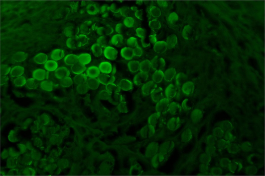 Normal healthy smooth muscle bundles emitting intrinsic autofluorescence when examined by fluorescent microscope. This picture is the control positive of the intrinsic autofluorescence of the normal healthy muscle bundles, and this ability disappear when occur degenerative changes to this muscle like of operation which made in all groups.