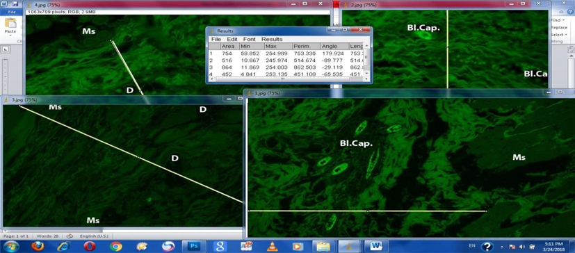 Displaying the data analysis of microphotographs of the four groups using image j software.
